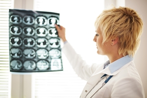 A healthcare professional with short blonde hair examines a sheet of medical X-ray images while considering a TPD Insurance Claim, standing by a window with blinds.