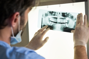 A person wearing gloves and a mask examines a dental X-ray image on a lightbox, carefully checking for signs that could indicate dental malpractice in the clear view of teeth and jaw.